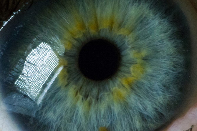 Google запатентовала электронные линзы, которые устанавливаются инъекцией в глаз